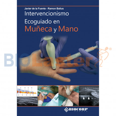 Intervencionismo ecoguiado en mueca y mano